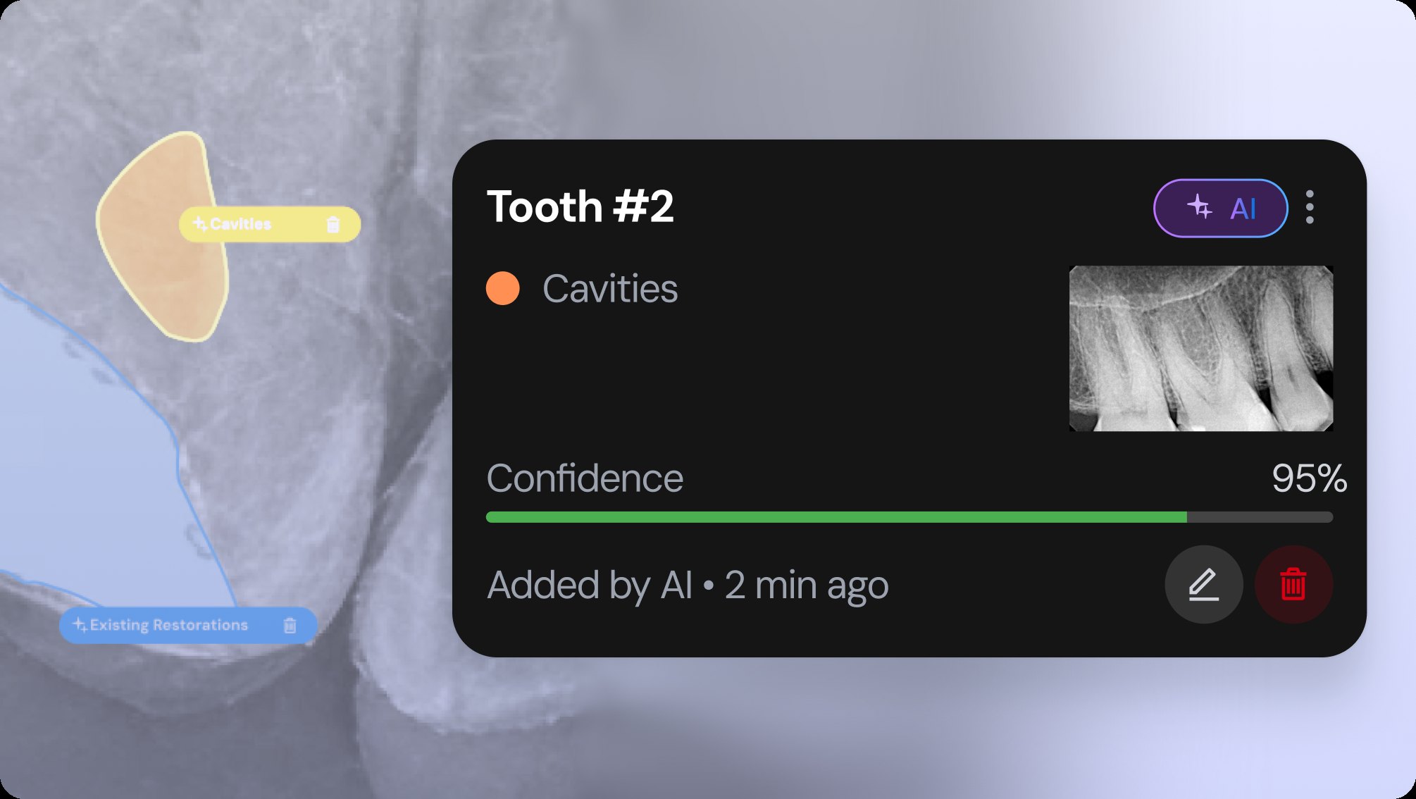 AI finding card for Tooth #2 with a 95% confidence bar and AI tag
