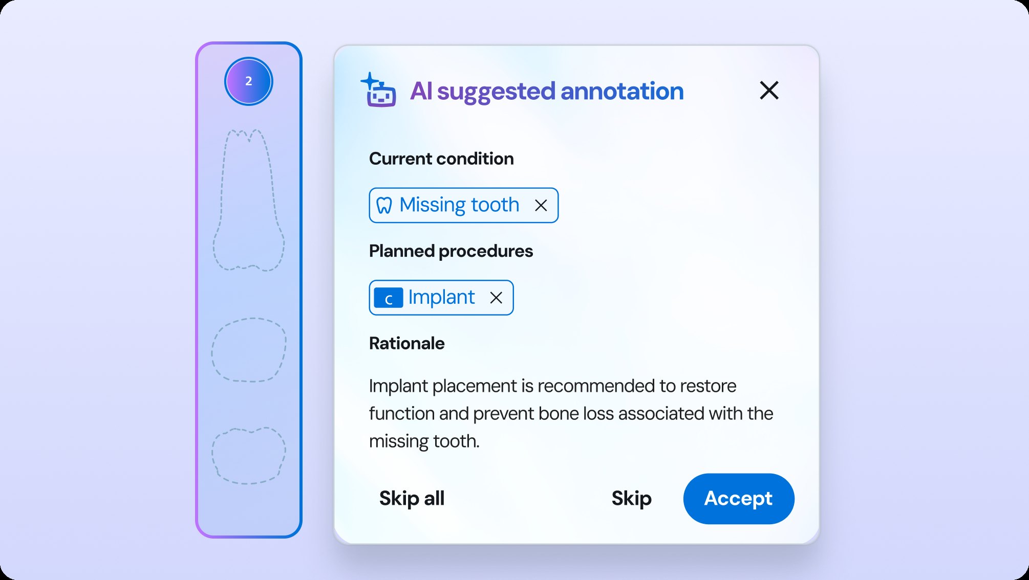 AI suggested annotation dialog with Accept, Skip and Skip all
