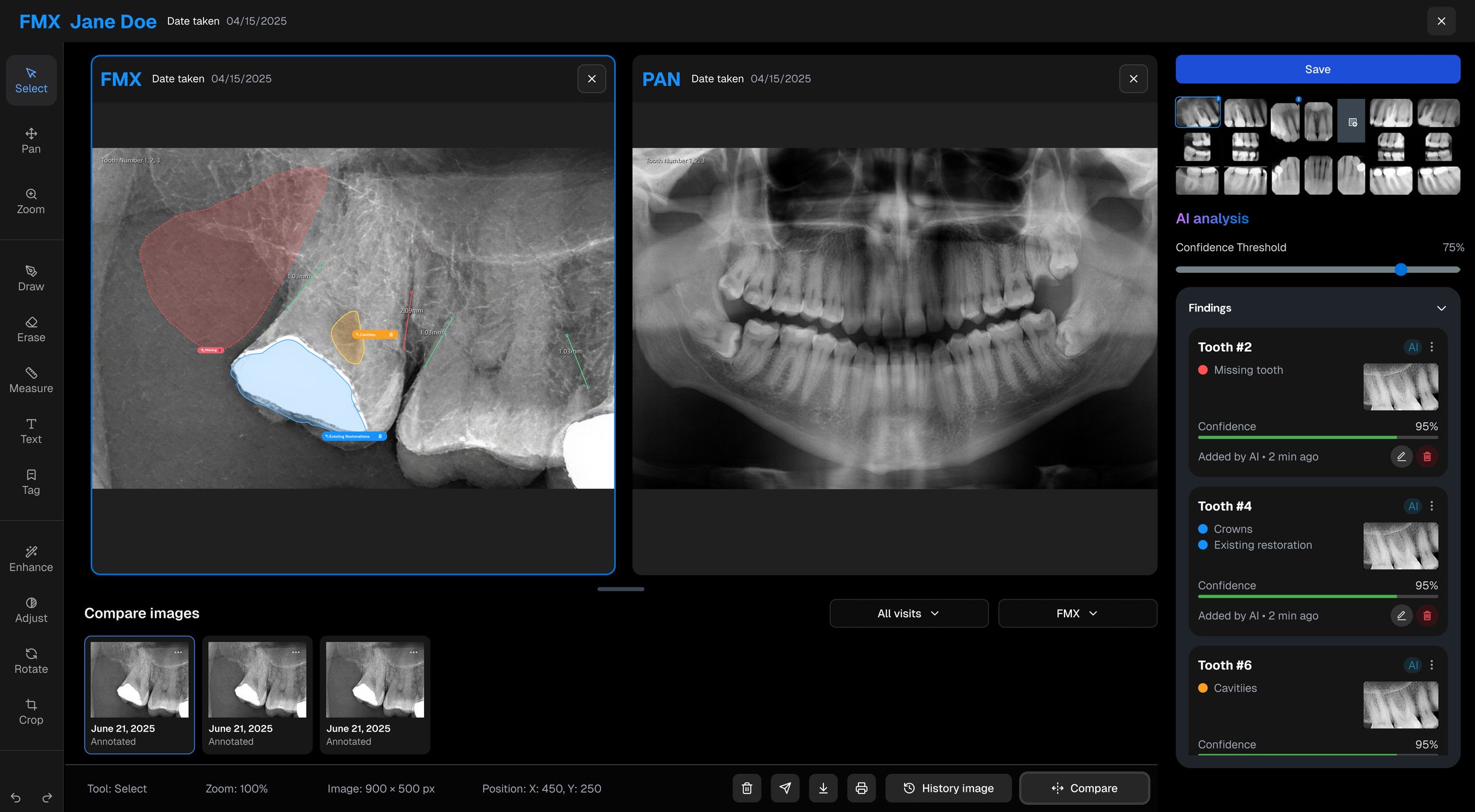 After: the redesigned viewer — FMX and PAN side by side, AI findings in foldable cards, a history browser and labeled actions
