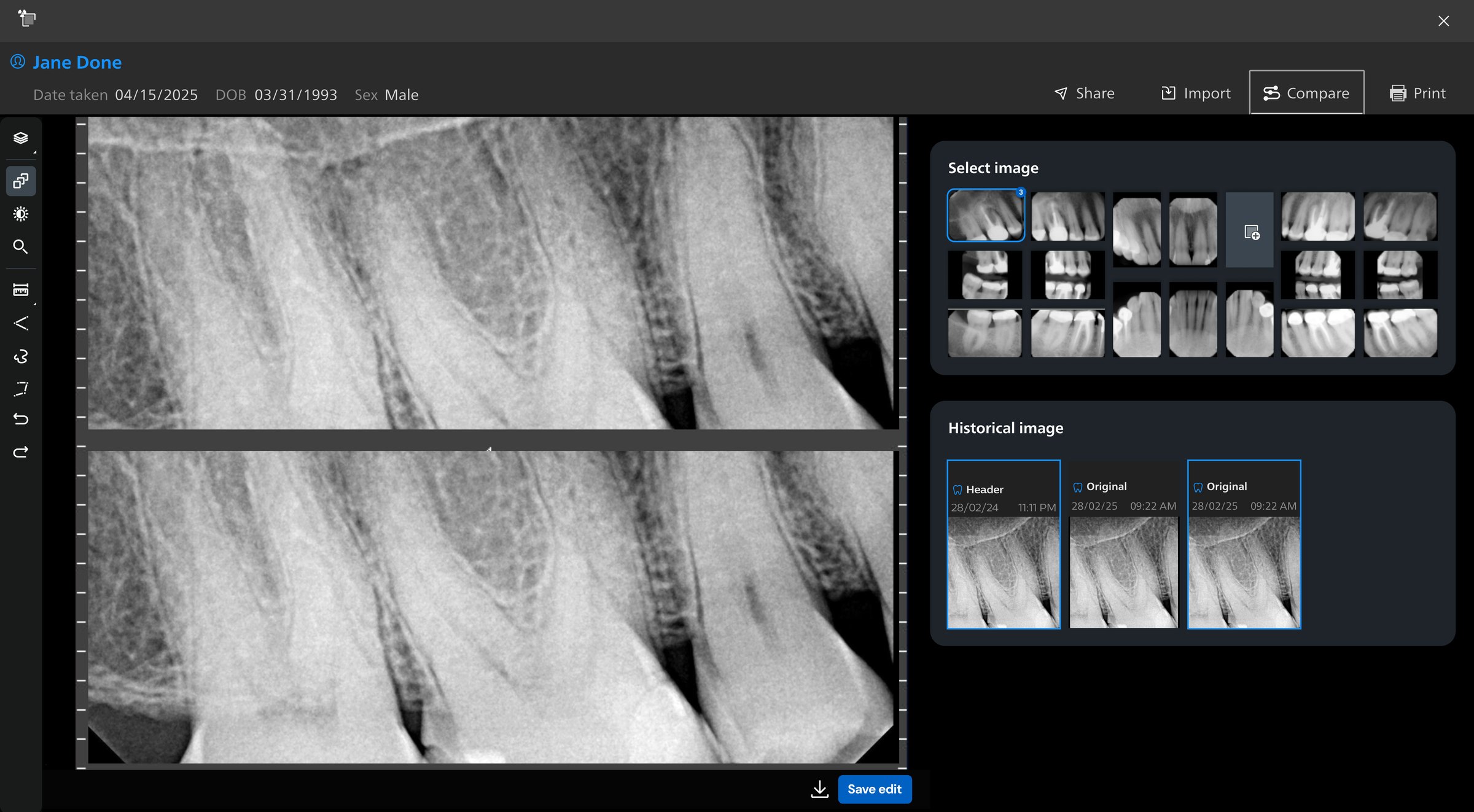 Before: the original image viewer — a single radiograph with a plain thumbnail grid and a short history strip